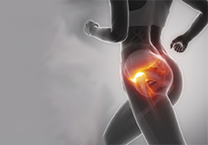 Muscle and Joint Pain